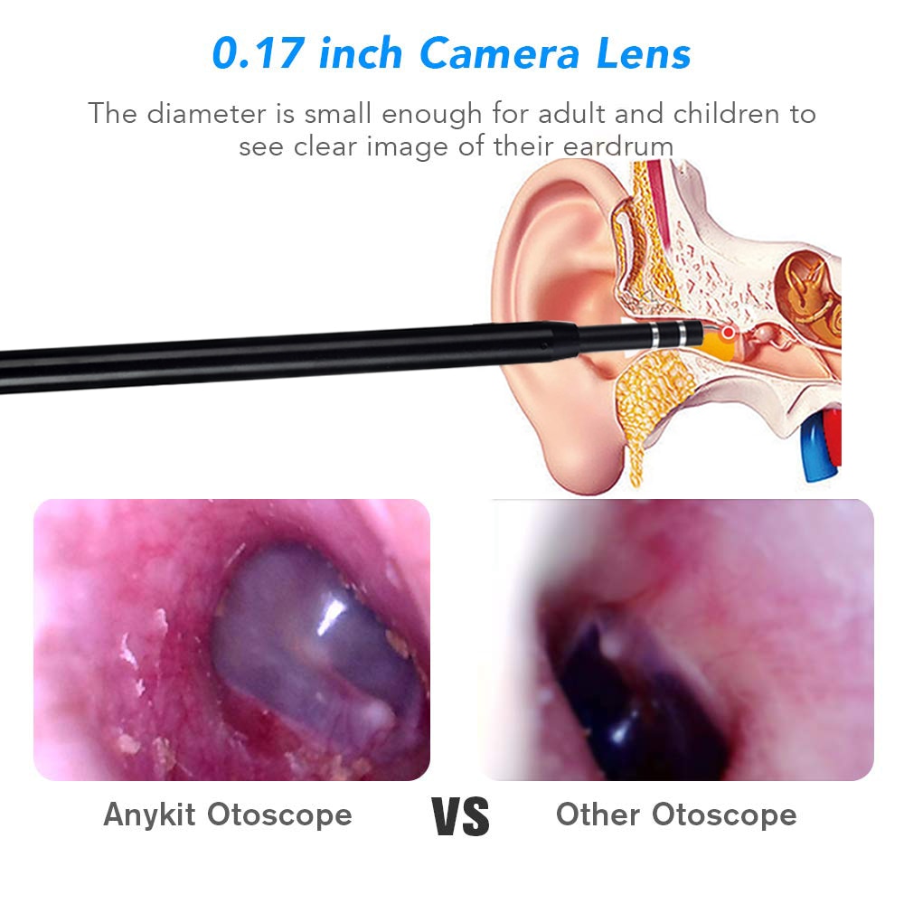 Caméra Otoscope HD - Micro USB, USB, USB Type-C