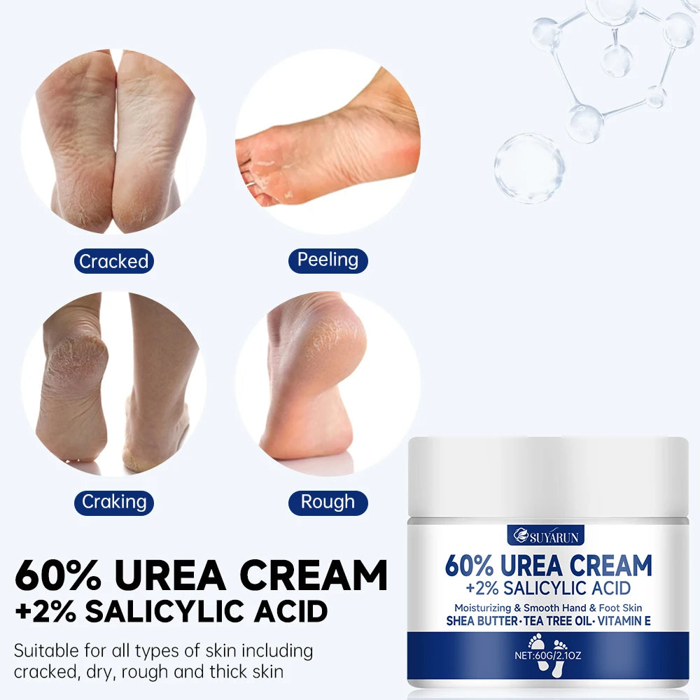 Crème pour Pieds à l’Urée 60 % – Soin Hydratant Intensif Talons Craquelés, Peaux Sèches et Callosités