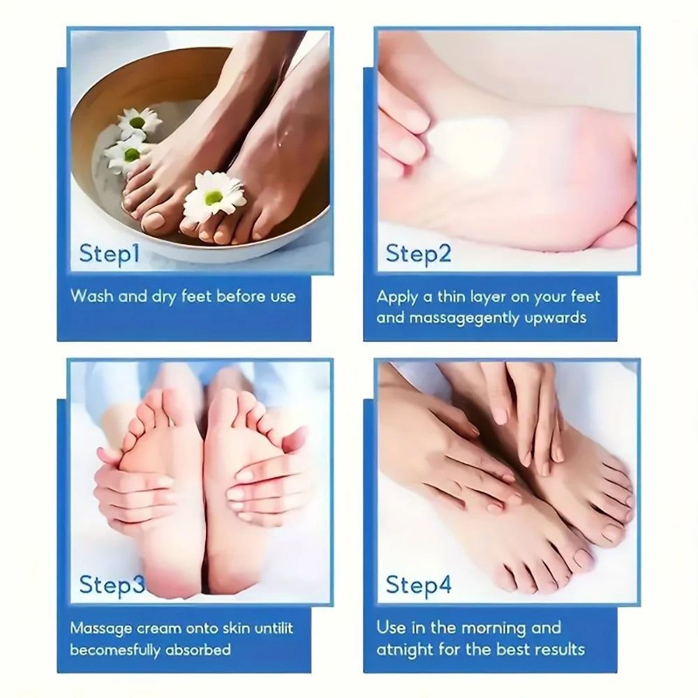 Crème pour Pieds à l’Urée 60 % – Soin Hydratant Intensif Talons Craquelés, Peaux Sèches et Callosités